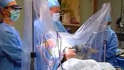 Bbc News Health Conscious During Brain Surgery