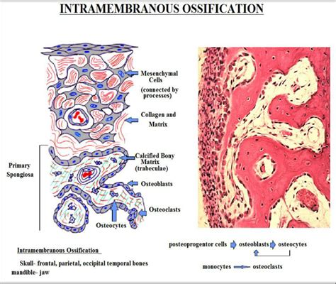 Intramembranous Ossification Histology