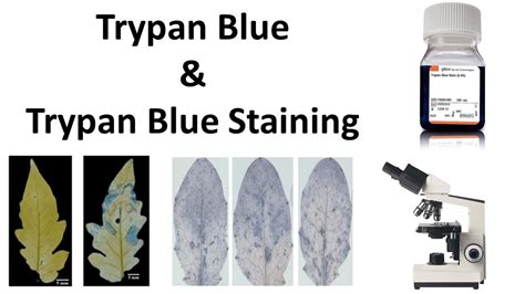 Trypan Blue Trypan Blue Staining Youtube