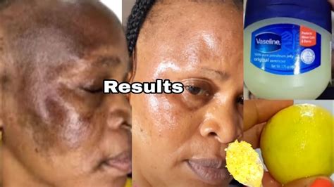 How To Apply Vaseline And Lemon On Face Apply Vaseline On Your Skin