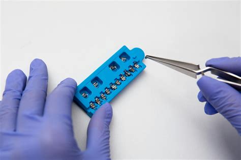Can a Fractured Tooth Root Heal Itself? [Comprehensive Answer] - CGAA