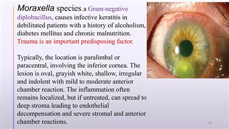 Bacterial Keratitis Ppt