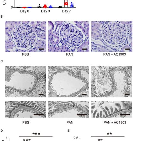 PDF TRPC5 Channel Inhibition Protects Podocytes In Puromycin