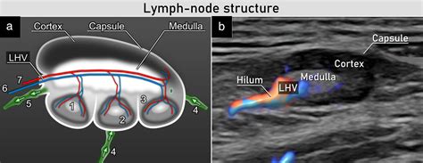 Groin Lymph Nodes Diagram