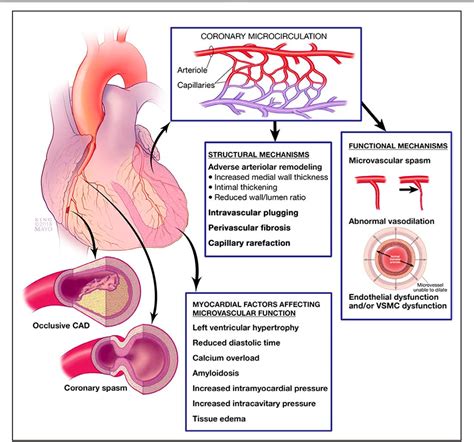 Figure 1 From Reappraisal Of Ischemic Heart Disease Fundamental Role