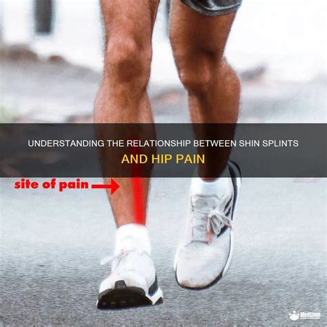 Understanding The Relationship Between Shin Splints And Hip Pain MedShun