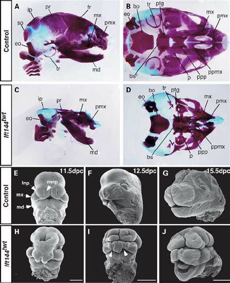 Craniofacial Phenotype Of Ift144 Twt Embryos A D Skulls Of 185