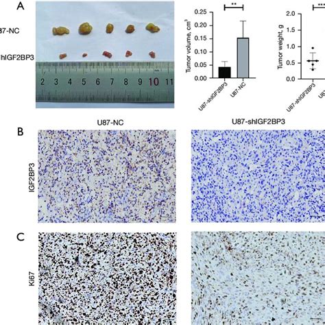 Igf Bp Knockdown In U Cells Suppressed Tumor Growth In The Nude