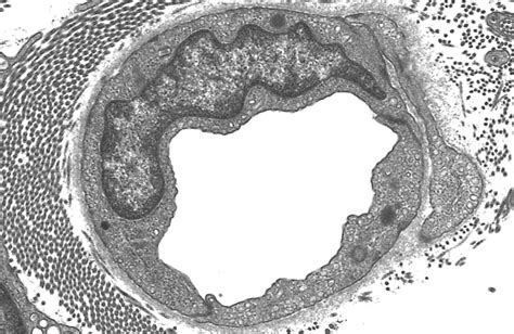 HLS Ultrastructure Of The Cell Continuous Capillaries Caveolae