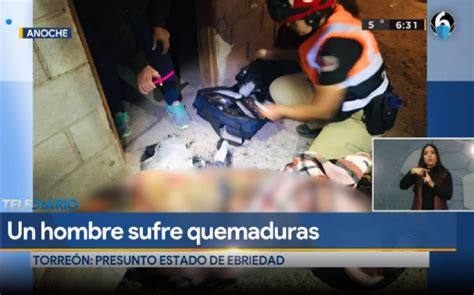 Hombre sufre graves quemaduras por incendio en Torreón Telediario México