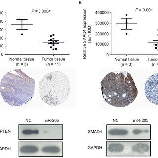 MiR 205 Suppresses The Expression Of PTEN And SMAD4 In Ovarian Cancer