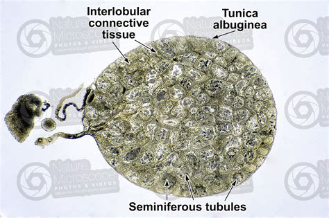 Rana Sp Frog Testicle Transverse Section 32x Rana Sp Frog