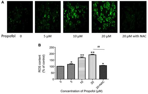 Propofol Induces ROSmediated Intrinsic Apoptosis And Migration In