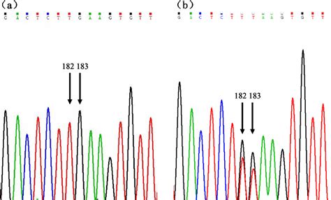 Table 1 From Single Nucleotide Polymorphisms In The Leptin A Gene And