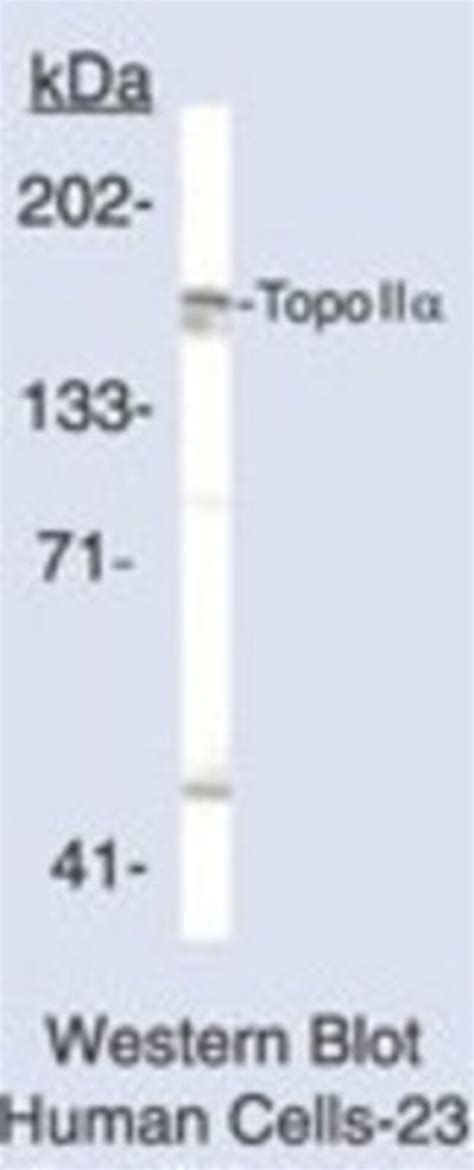 topa antibody novus biologicals ml unlabeledantibodies