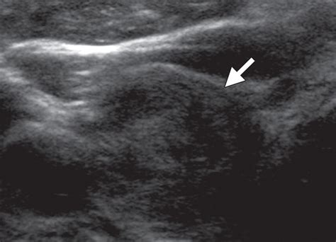 The Thyroid Review Of Imaging Features And Biopsy Techniques With Radiologic Pathologic