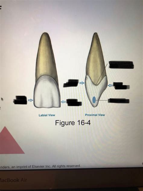 Anterior Teeth Part 2 Diagram Quizlet