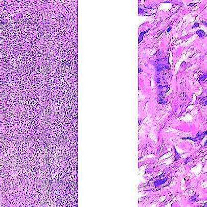 -Comparison of normal thymus (A, B), atypical thymic hyperplasia (C, D)... | Download Scientific ...