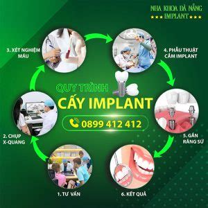 Price list for dental implant services Nha khoa Đà Nẵng Implant