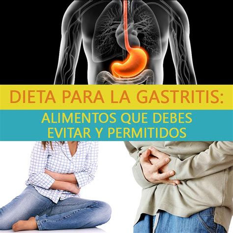 Dieta Para La Gastritis Alimentos Que Debes Evitar Y Permitidos La Guía De Las Vitaminas