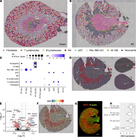 Colocalization Of Immune Clusters In The Ischemia Reperfusion Injury