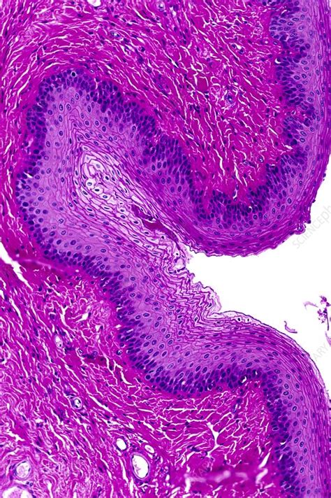 Stratified Squamous Epithelium Cartoon