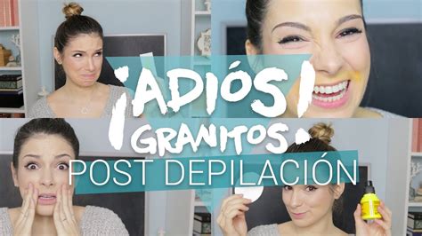 Granos De Fordyce Labios Porque Salen References Labios Tatuados