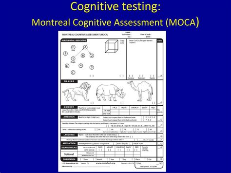 Montreal Cognitive Assessment Moca 2 Volfmailer