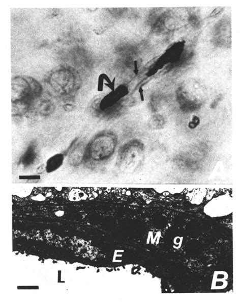 Histochemical And Ultrastructural Appearance Of Brain Mast Cells A