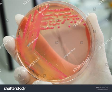 Pink Mucoid Colonies Klebsiella Pneumoniae On 스톡 사진 1020751009