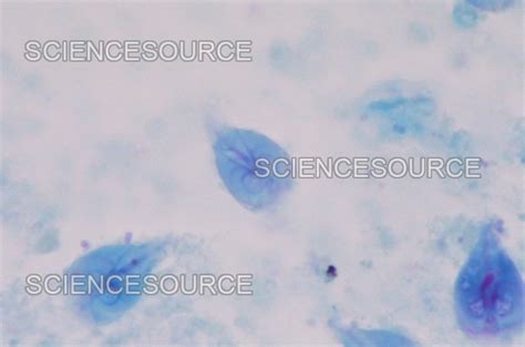 Photograph Giardia Lamblia Lm Science Source Images