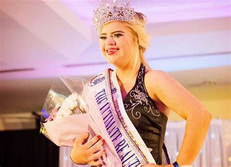 Jovem Com Síndrome De Down Vence Concurso De Miss Na Irlanda Do Norte