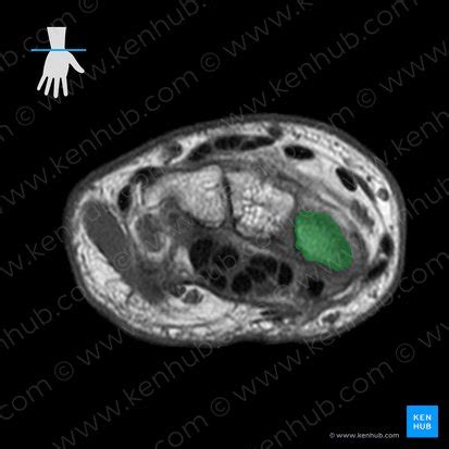 Scaphoid: Anatomy, classification and function | Kenhub