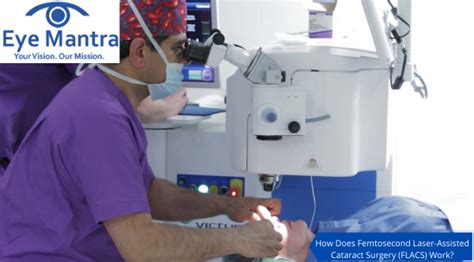 Femtosecond Laser-Assisted Cataract Surgery: A Review | Its Benefits