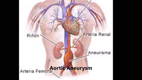 Enfermedades Del Sistema Circulatorio Youtube