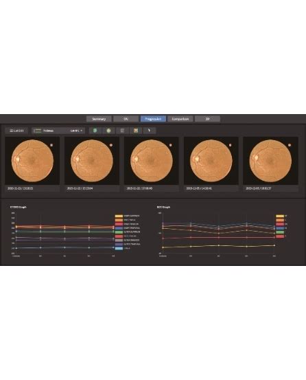 HUVITZ HOCT 1 1 F Ürünler Huvitz Emos Elektronik Medikal