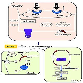 Hyperinsulinemia act as the central player in the crossroad of ...