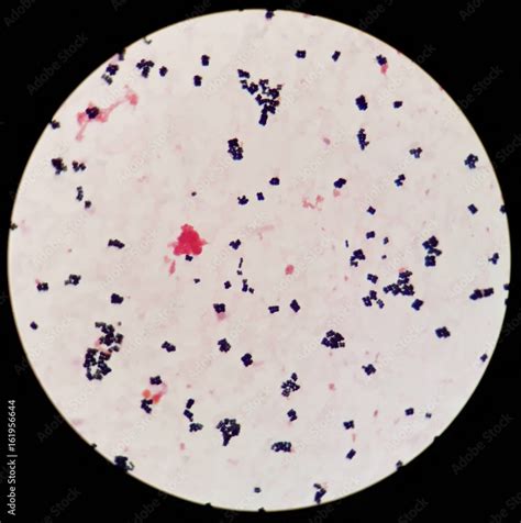 Cocci Bacteria Under Microscope