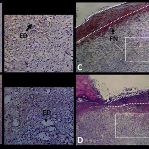 Histological Feature Of Experimentally Induced Wound On 21 After