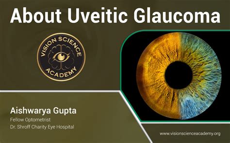 About Uveitic Glaucoma - Vision Science Academy