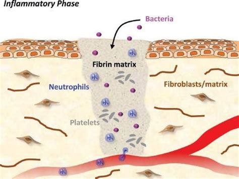 Inflammatory Phase Of Wound Healing Begins Immediately After Tissue