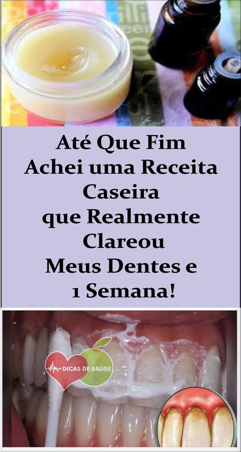 Este Truque Caseiro Simples Elimina O T Rtaro E Deixa Os Dentes Limpos