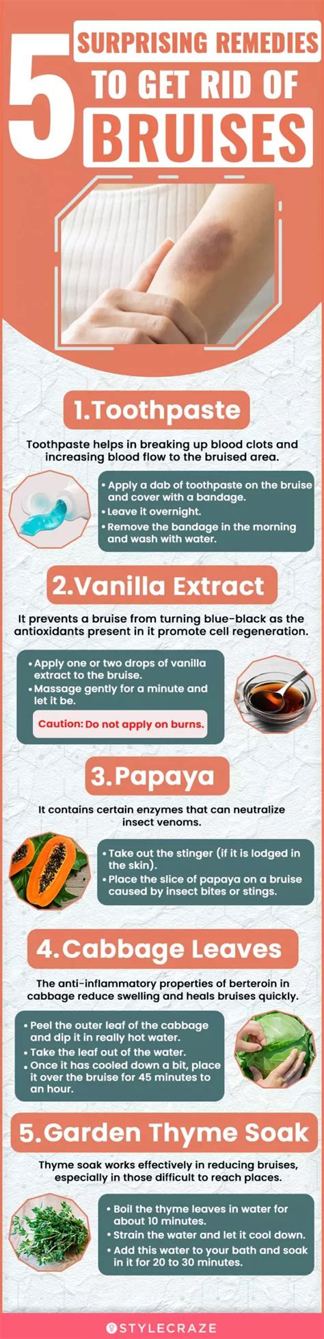 21 Effective Home Remedies For Bruises