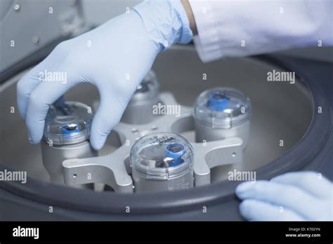 El plasma rico en plaquetas PRP laboratorio preparación clínica médica