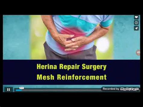 Relion Group Tv Commercial Hernia Mesh Revision Surgery Youtube