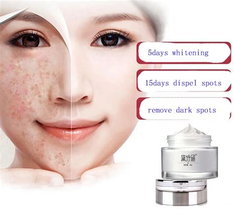 Dark Spot Corrector Skin Whitening Fade Cream Lightening Blemish Removal Serum Reduces Age Spots ...