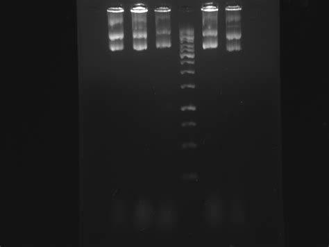 What are the reasons for smeared band in agarose gel electrophoresis ...