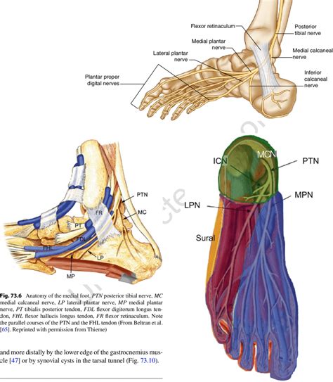 Tibial Nerve Entrapment