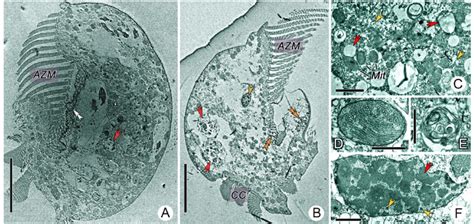 Transmission Electron Micrographs Showing The Cytoplasm And Cytoplasmic