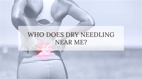 Who Does Dry Needling Near Me? - Acupuncture , Dry Needling ...